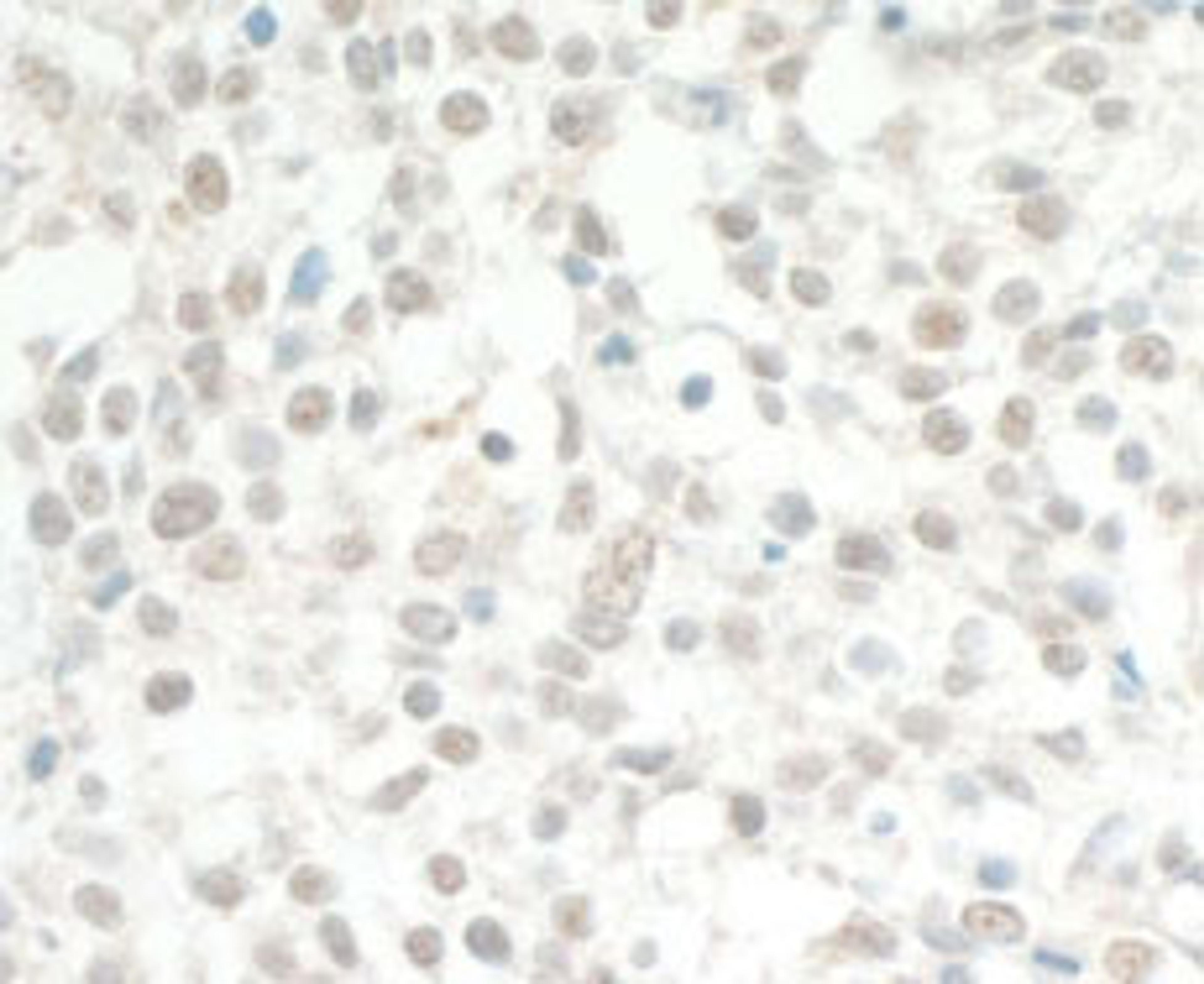 Detection of human MED13L by immunohistochemistry.