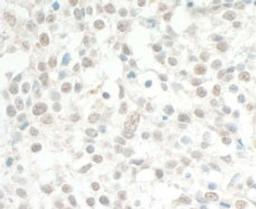 Detection of human MED13L by immunohistochemistry.