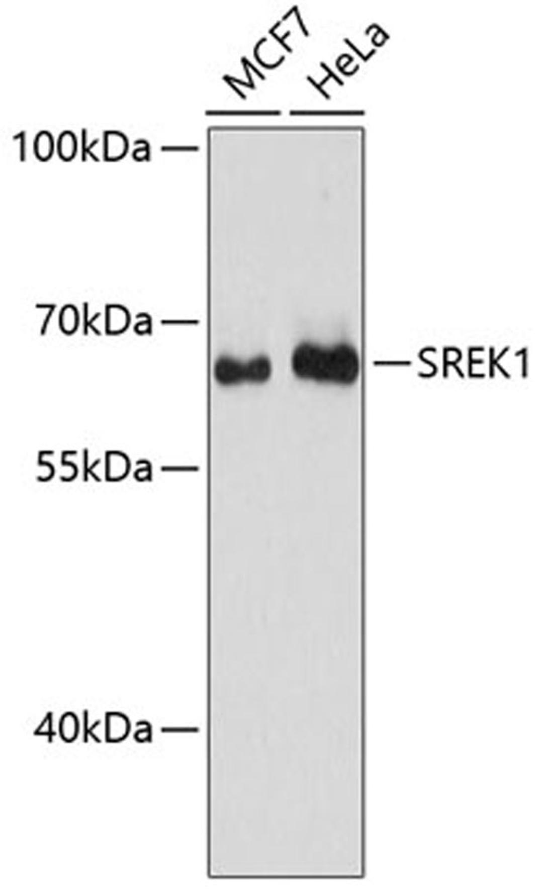 Western blot - SREK1 antibody (A13235)