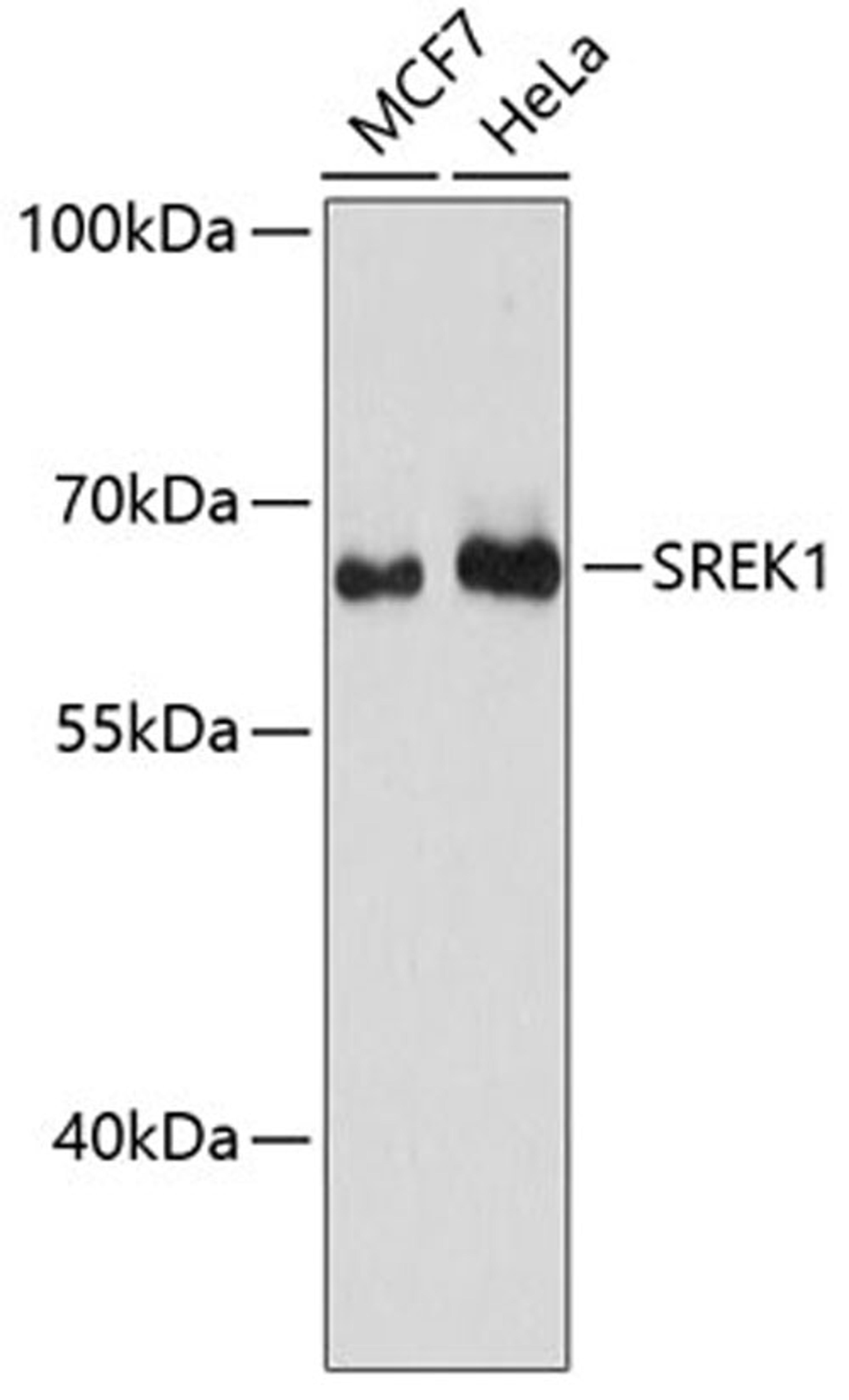 Western blot - SREK1 antibody (A13235)