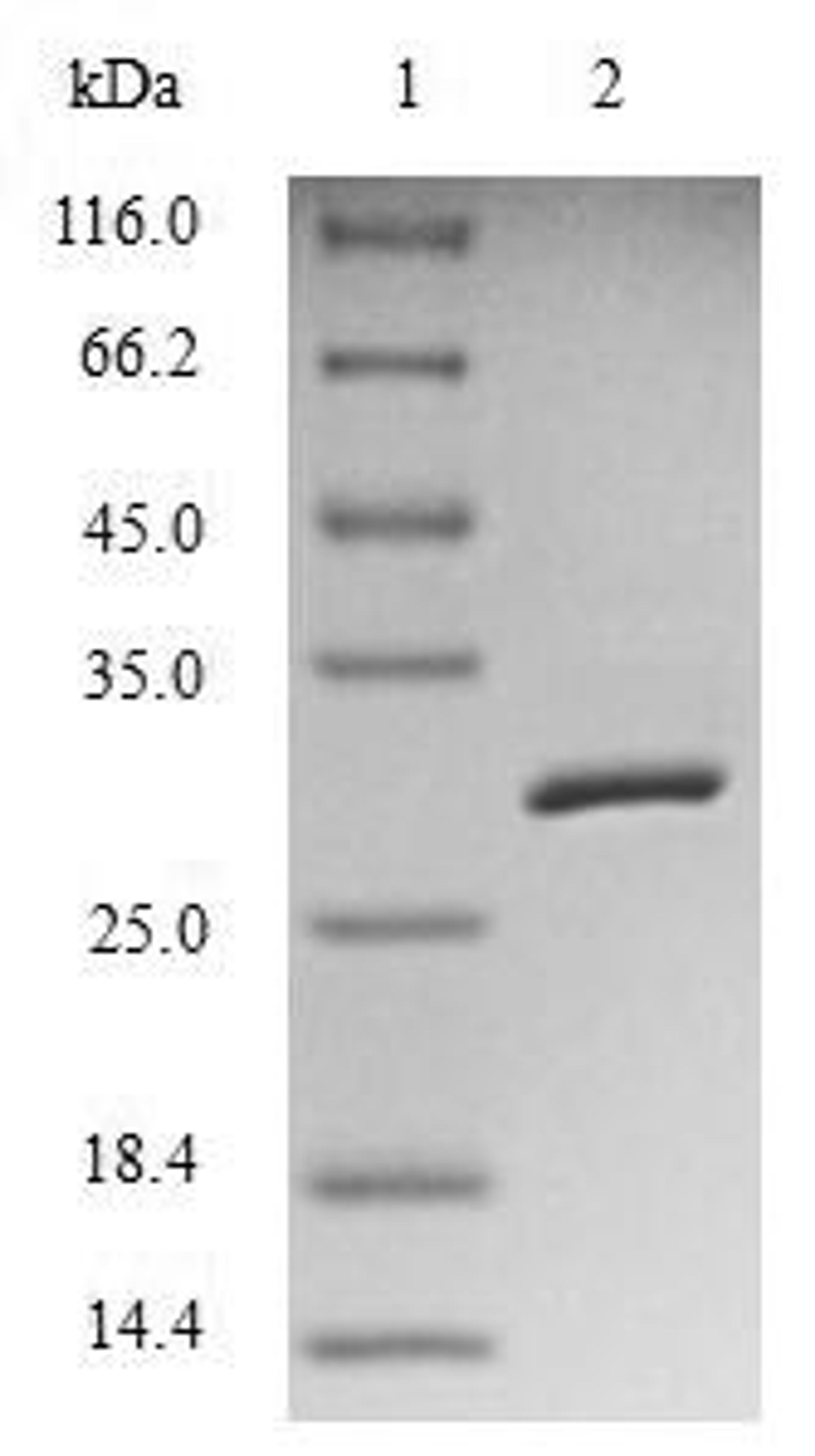 (Tris-Glycine gel) Discontinuous SDS-PAGE (reduced) with 5% enrichment gel and 15% separation gel.