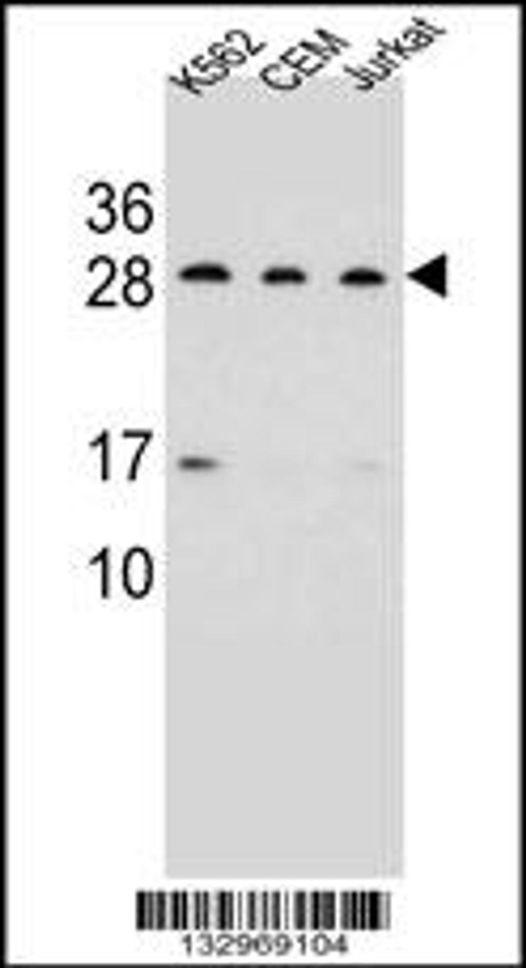 Western blot analysis in K562,CEM,Jurkat cell line lysates (35ug/lane).