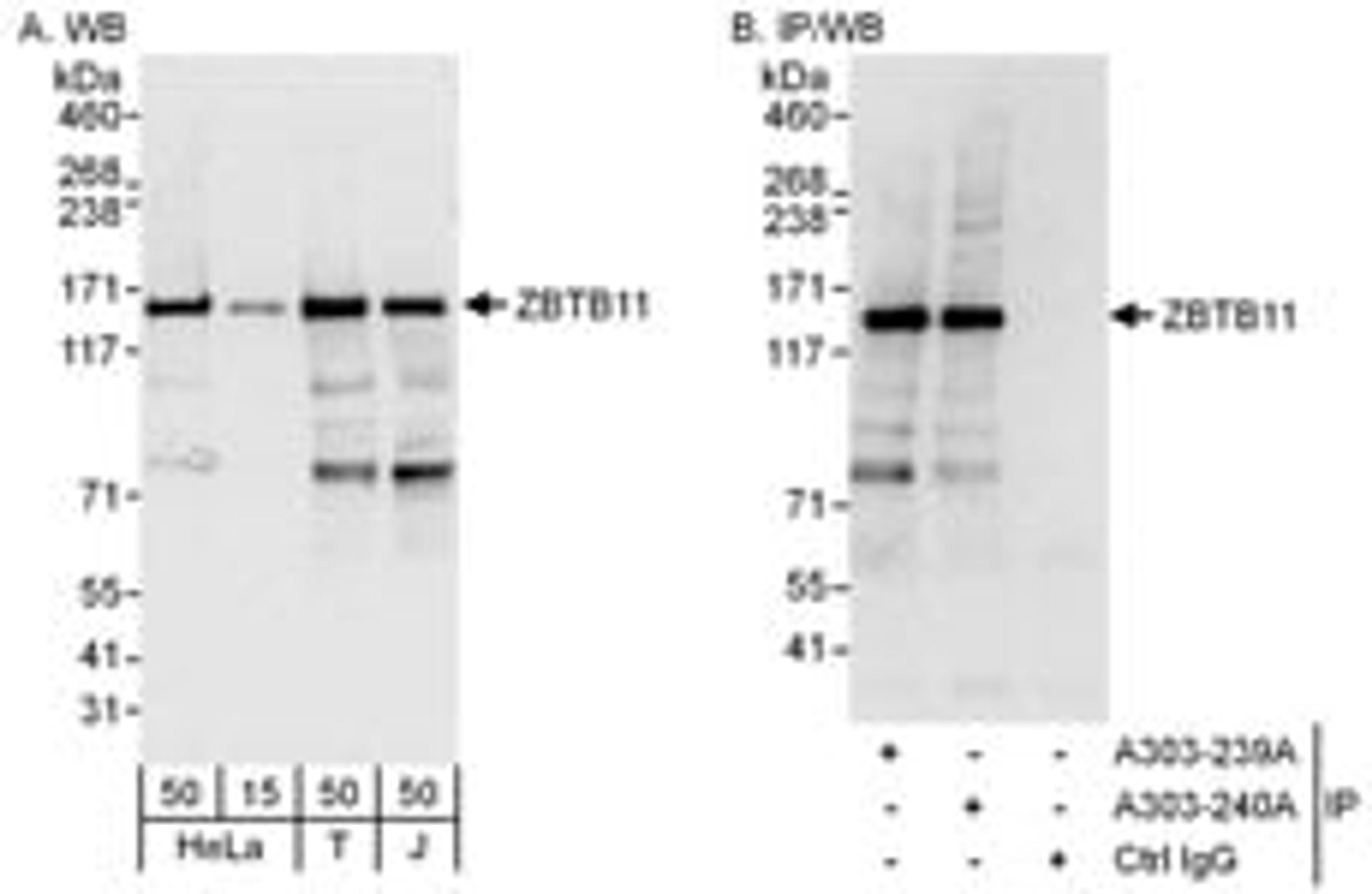 Detection of human ZBTB11 by western blot and immunoprecipitation.