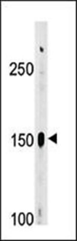 Western blot analysis of A2058 cell line lysates (35ug/lane) using ABL2 (phosphorylated) antibody