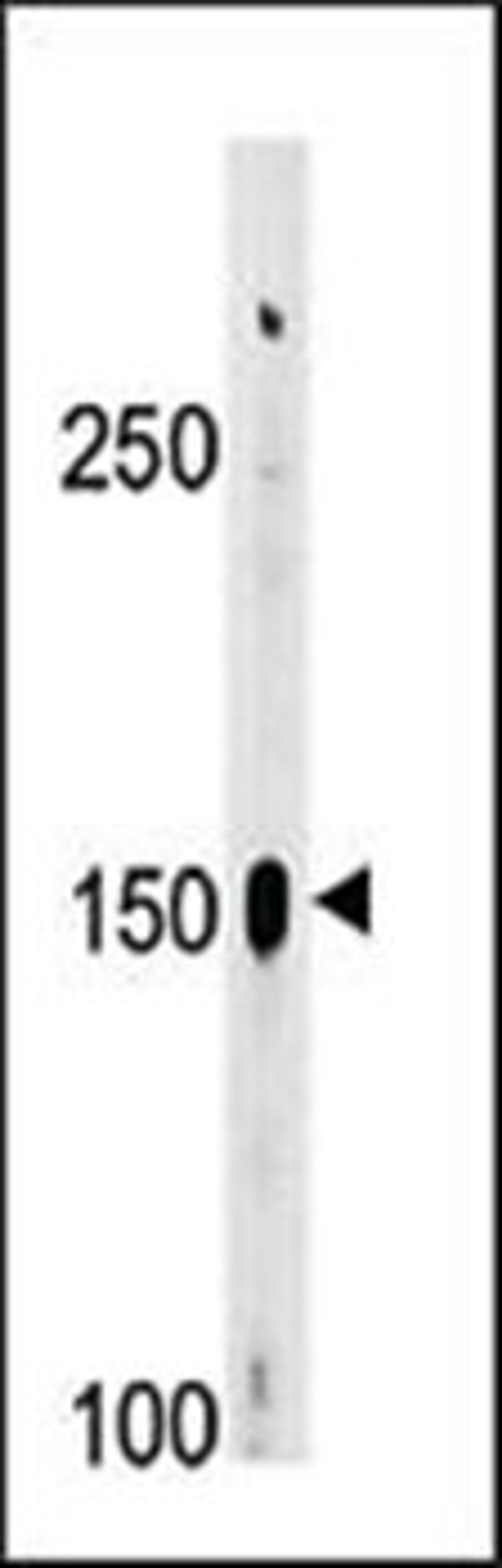 Western blot analysis of A2058 cell line lysates (35ug/lane) using ABL2 (phosphorylated) antibody