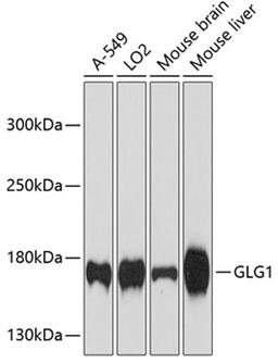 Western blot - GLG1 antibody (A12024)