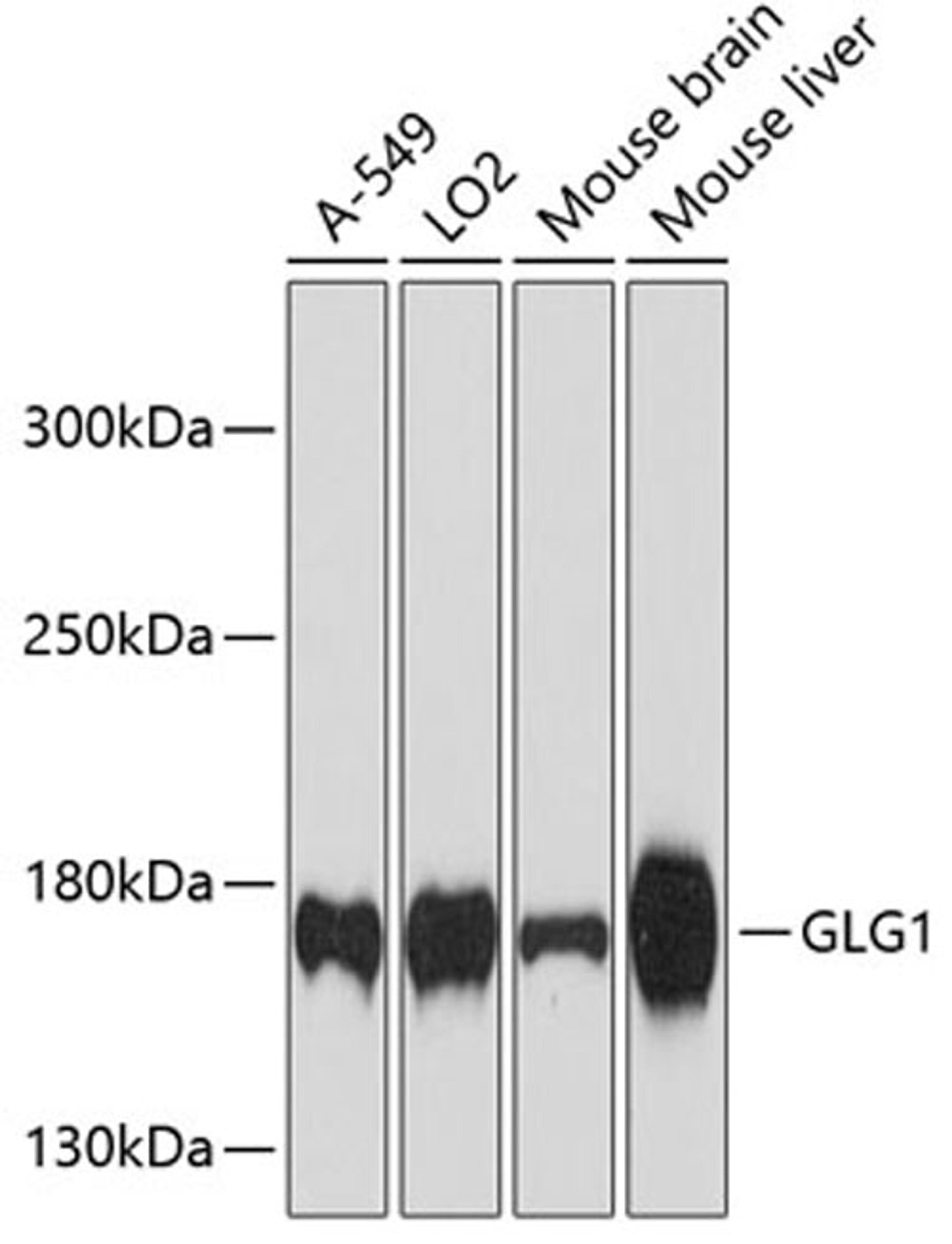 Western blot - GLG1 antibody (A12024)