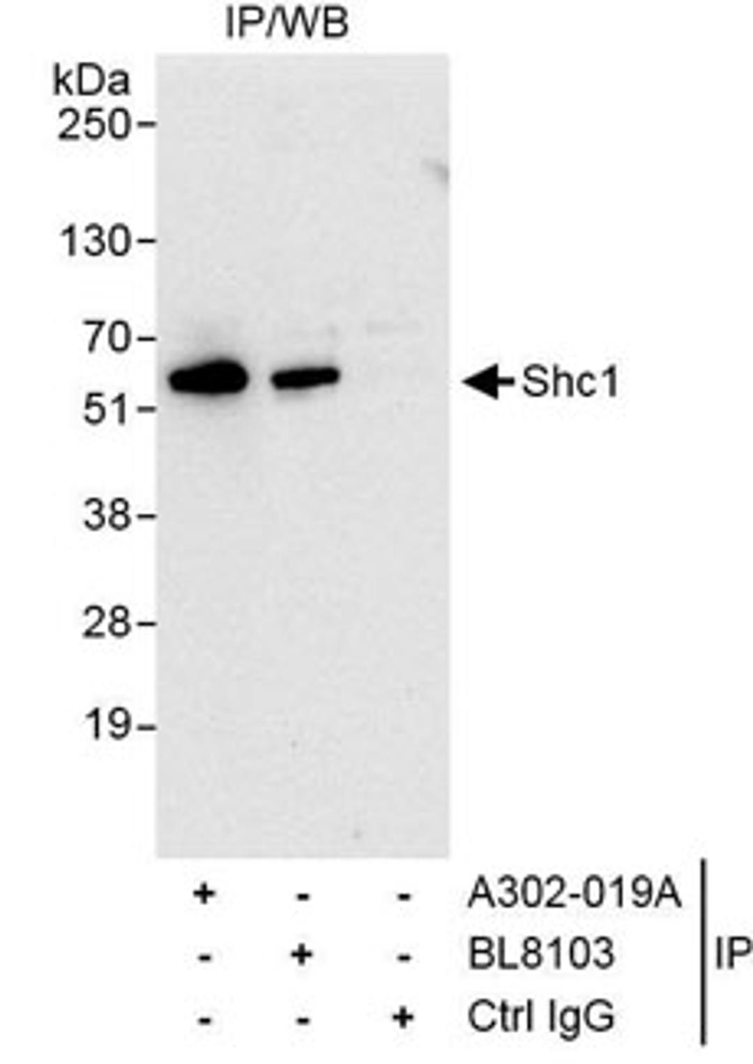 Detection of human Shc1 by western blot of immunoprecipitates.