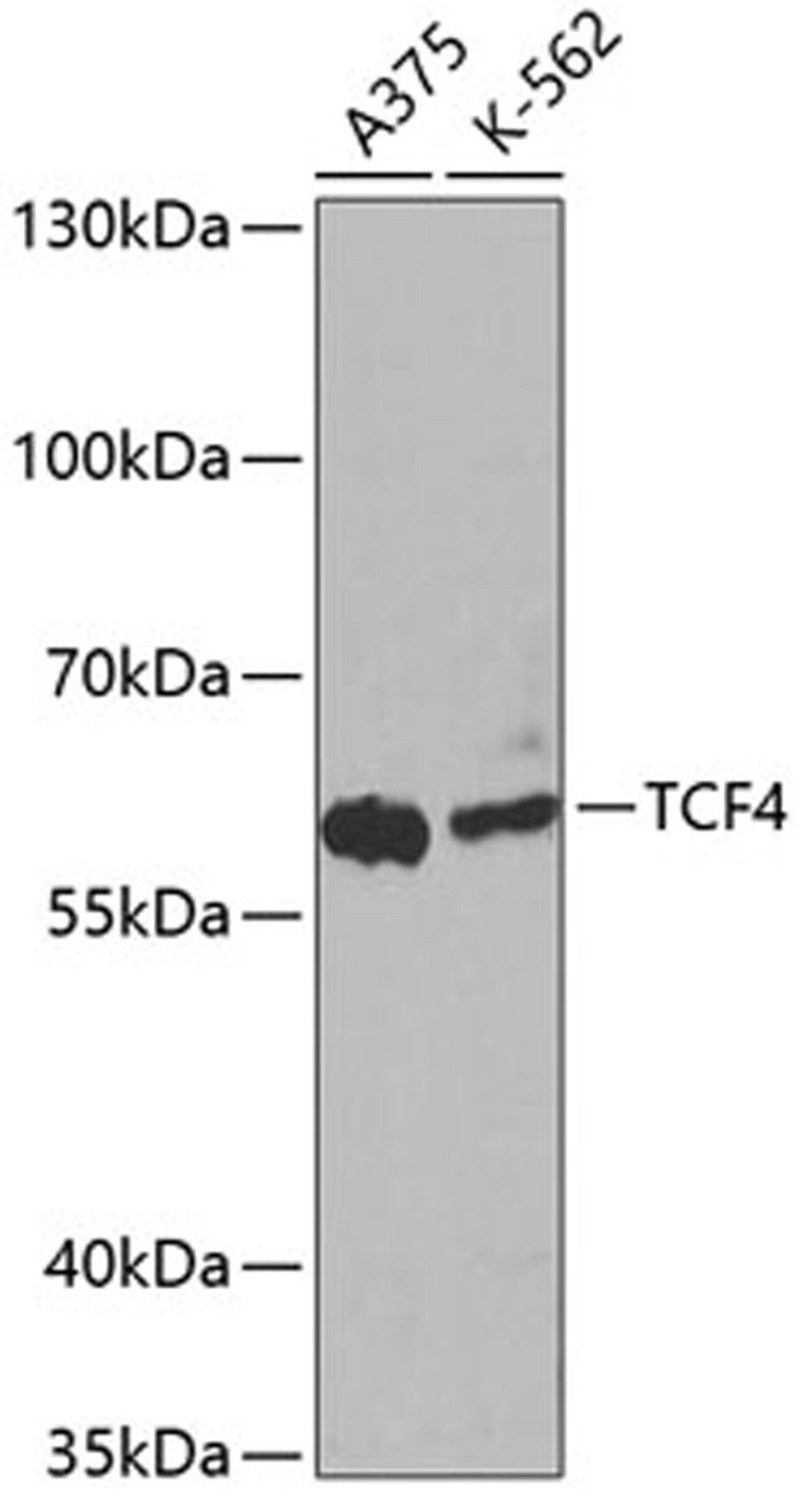 Western blot - TCF4 antibody (A1141)