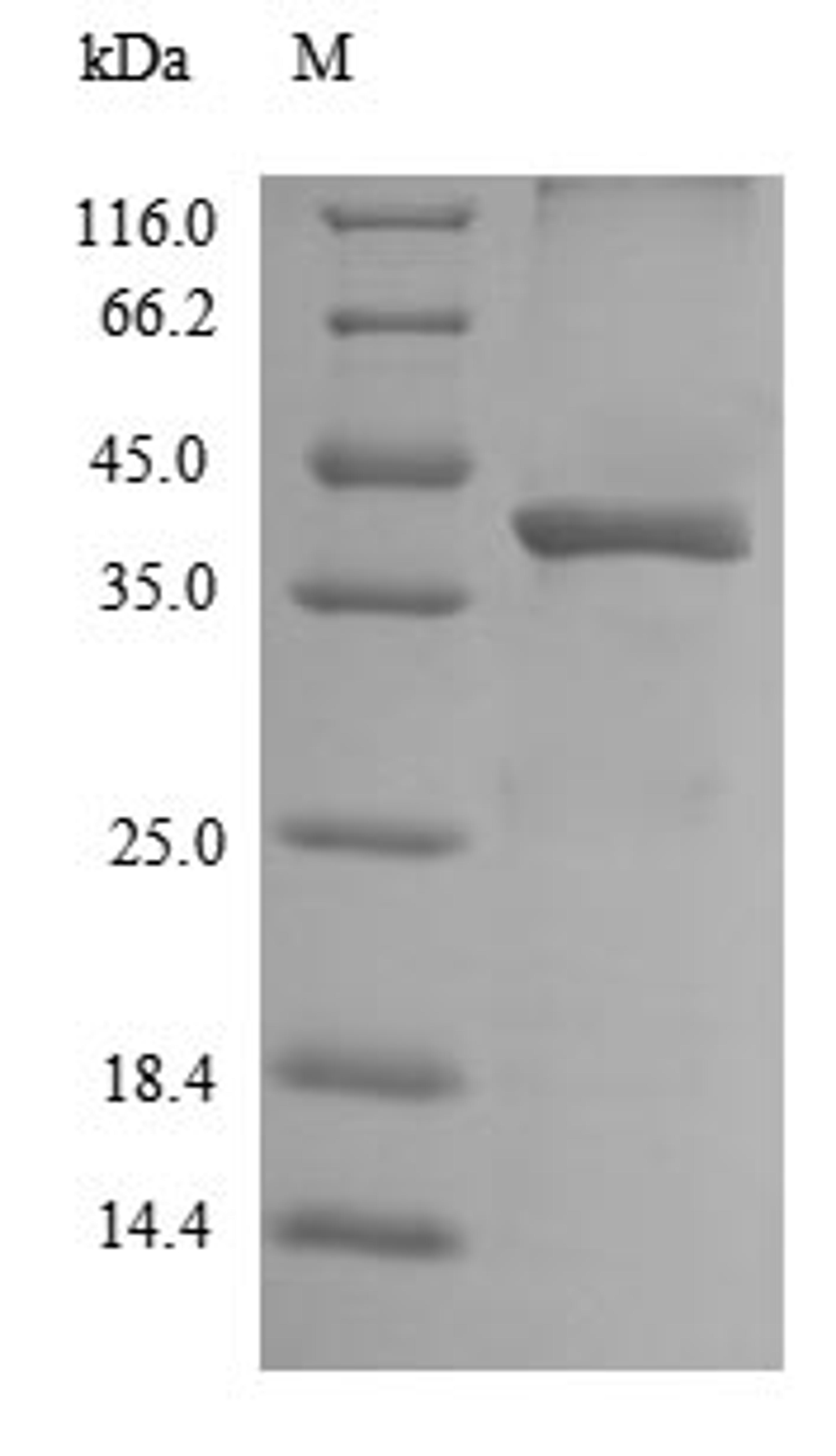 (Tris-Glycine gel) Discontinuous SDS-PAGE (reduced) with 5% enrichment gel and 15% separation gel.