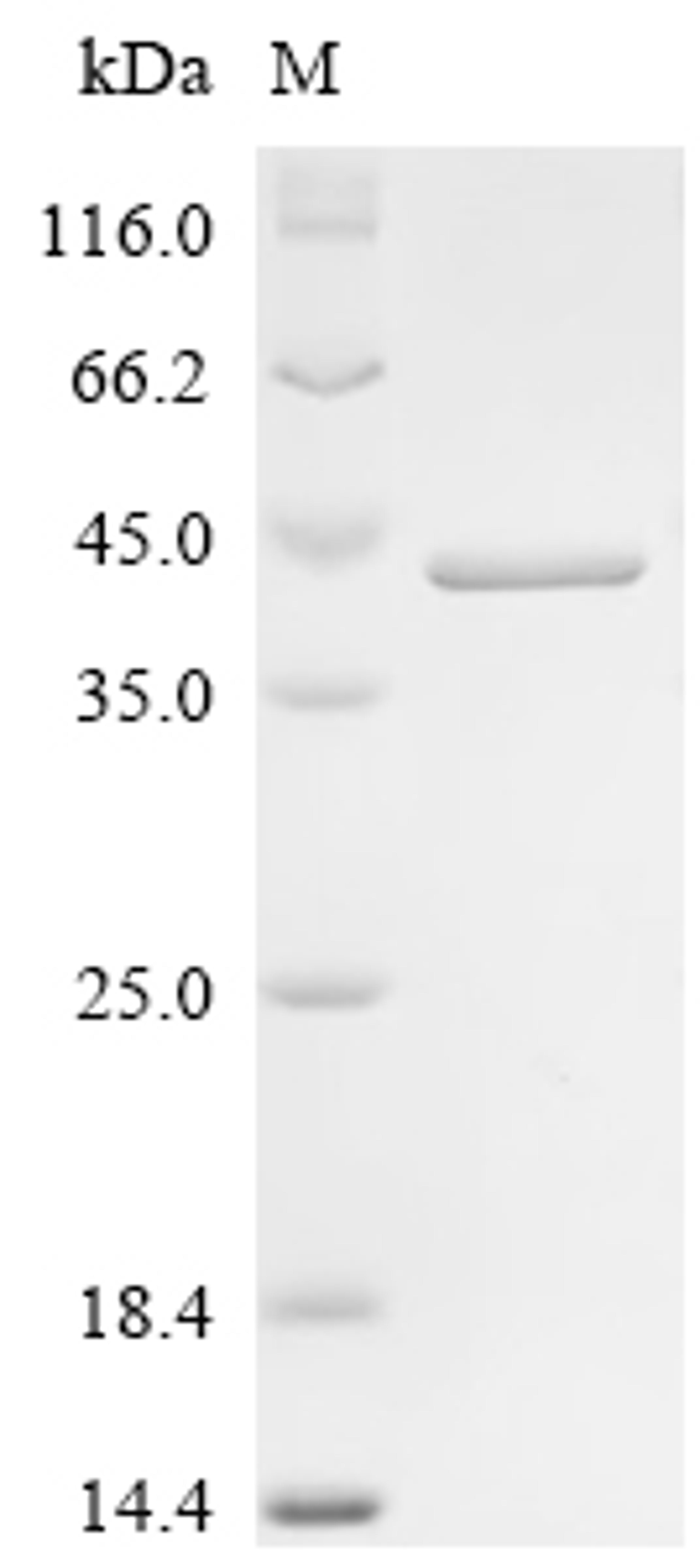 (Tris-Glycine gel) Discontinuous SDS-PAGE (reduced) with 5% enrichment gel and 15% separation gel.