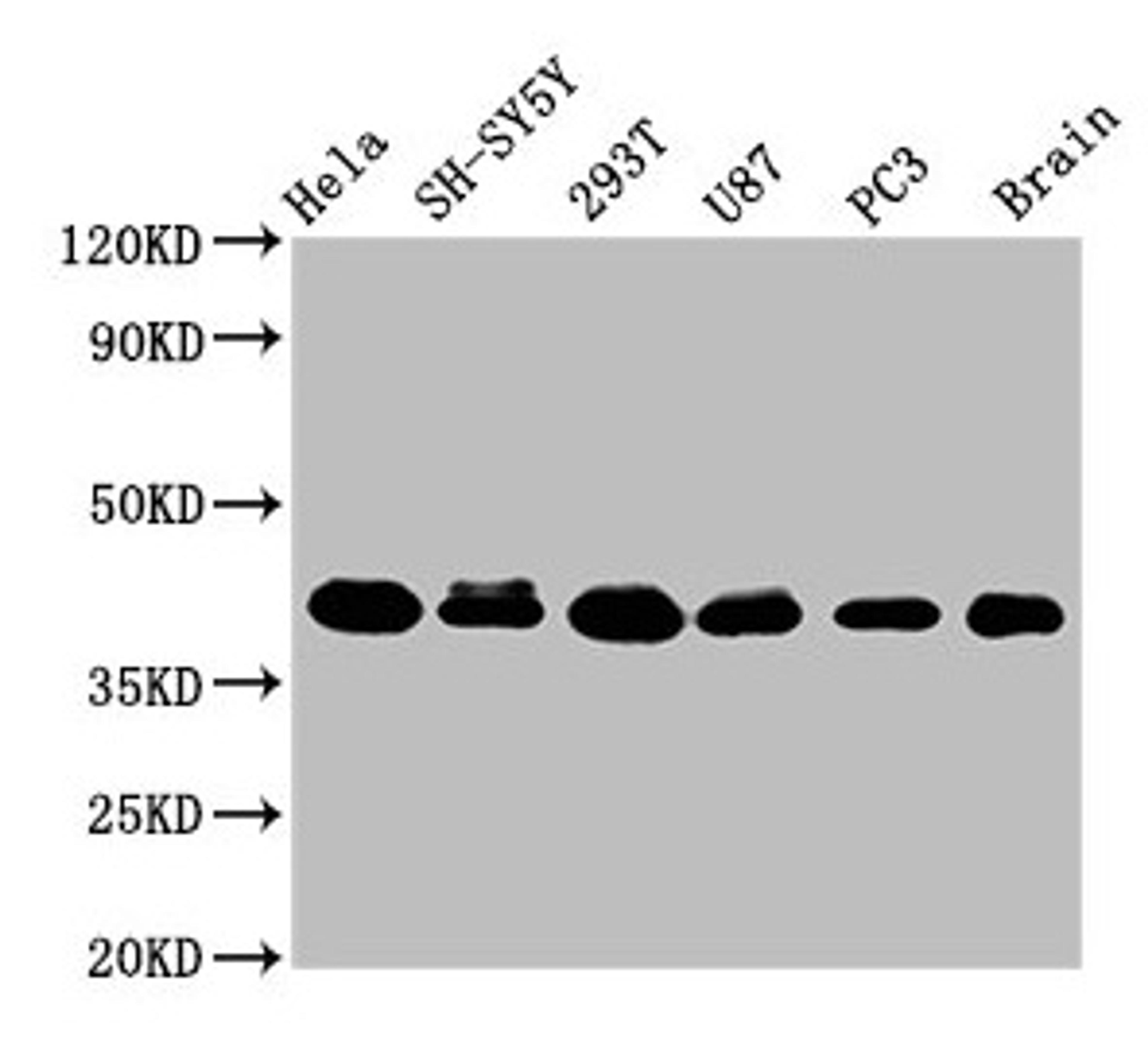Western Blot. Positive WB detected in: Hela whole cell lysate, SH-SY5Y whole cell lysate, 293T whole cell lysate, U87 whole cell lysate, PC-3 whole cell lysate, Rat brain tissue. All lanes: KTI12 antibody at 3.2µg/ml. Secondary. Goat polyclonal to rabbit IgG at 1/50000 dilution. Predicted band size: 39 kDa. Observed band size: 39 kDa