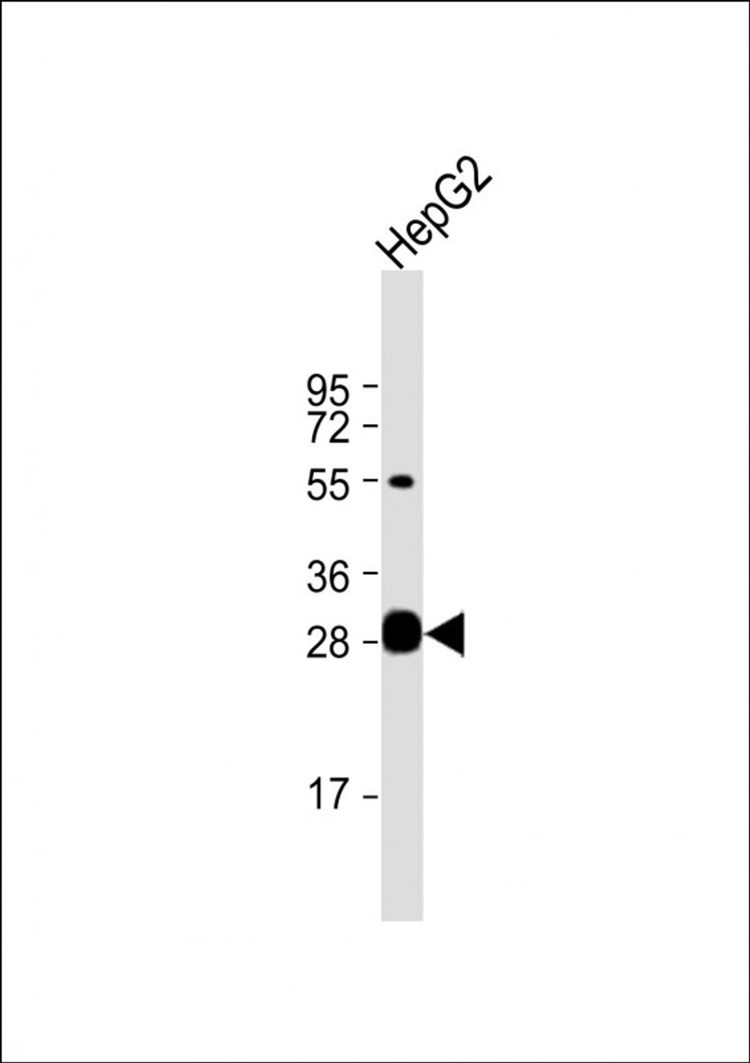 Western Blot at 1:1000 dilution + HepG2 whole cell lysate Lysates/proteins at 20 ug per lane.