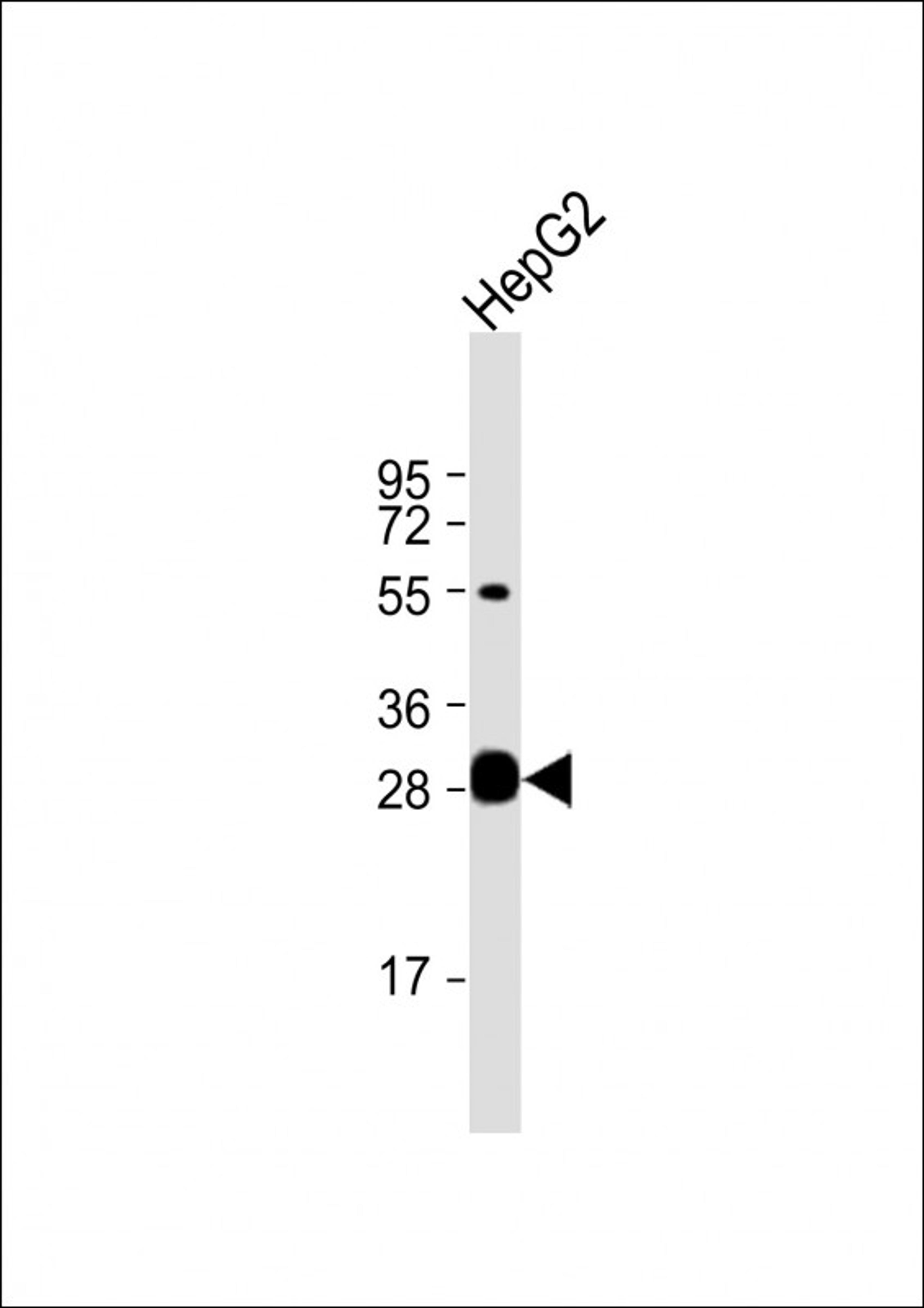 Western Blot at 1:1000 dilution + HepG2 whole cell lysate Lysates/proteins at 20 ug per lane.