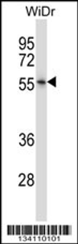 Western blot analysis in WiDr cell line lysates (35ug/lane).