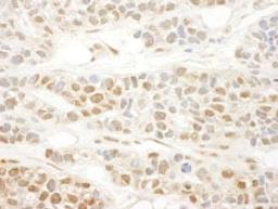 Detection of human MKL1 by immunohistochemistry.