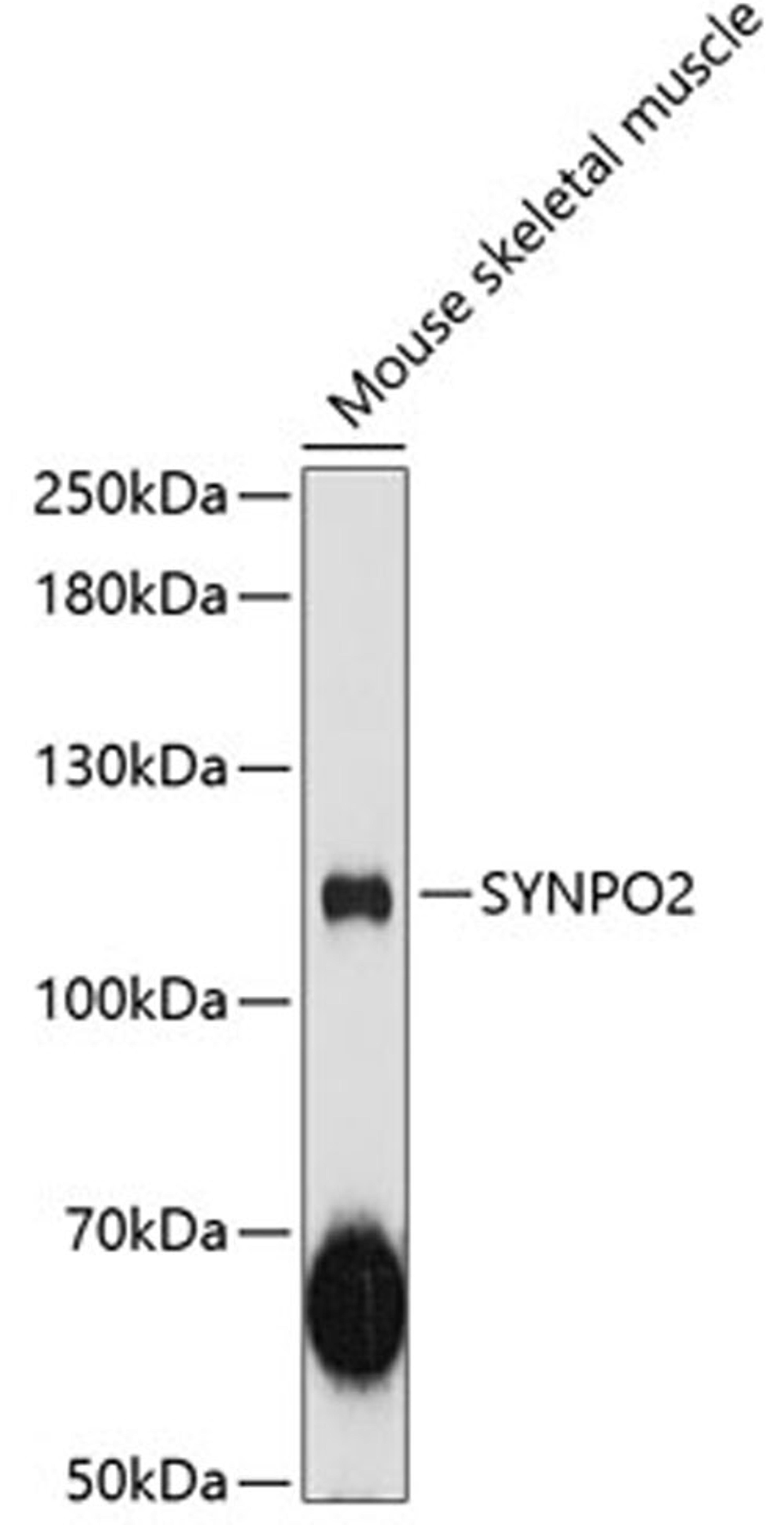 Western blot - SYNPO2 antibody (A12881)