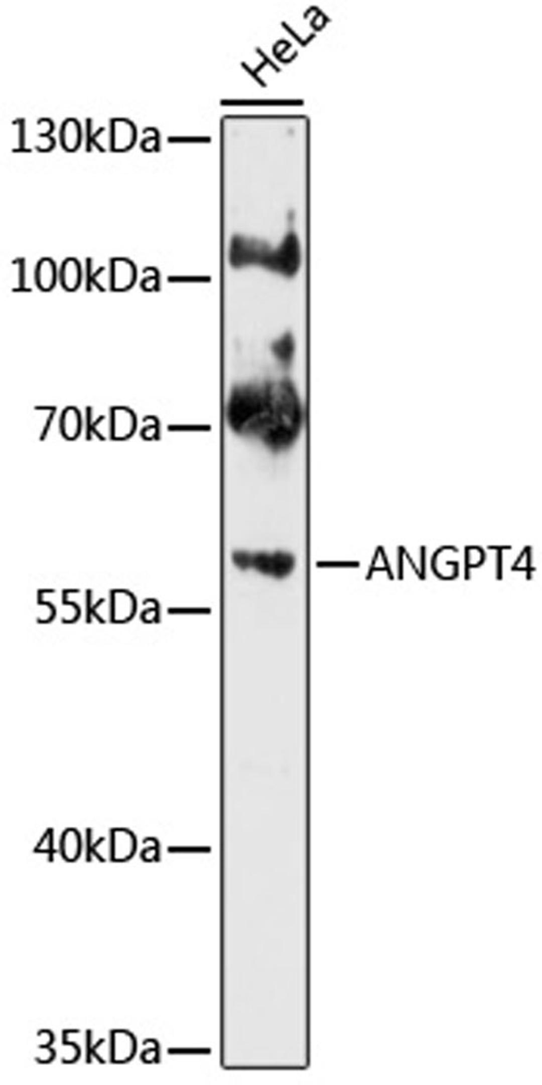 Western blot - ANGPT4 antibody (A10589)