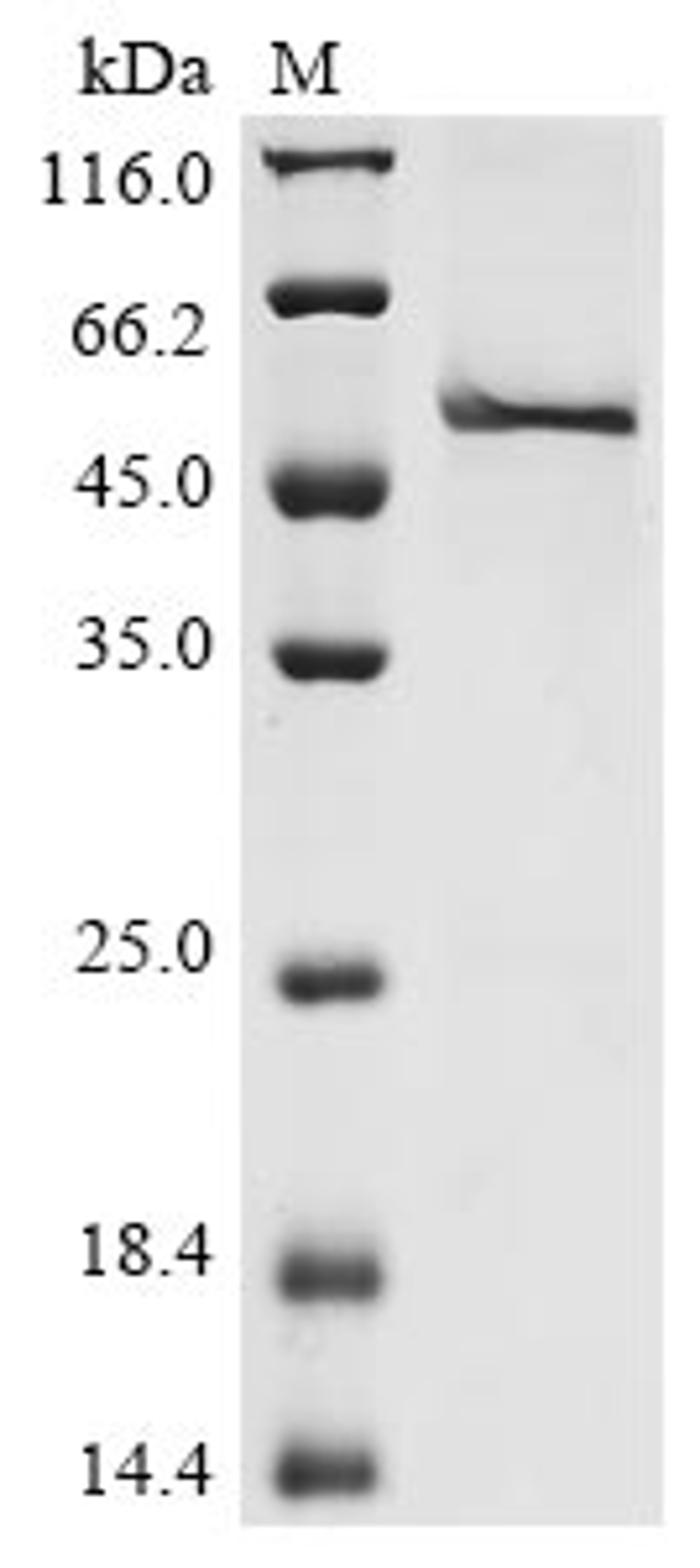 (Tris-Glycine gel) Discontinuous SDS-PAGE (reduced) with 5% enrichment gel and 15% separation gel.