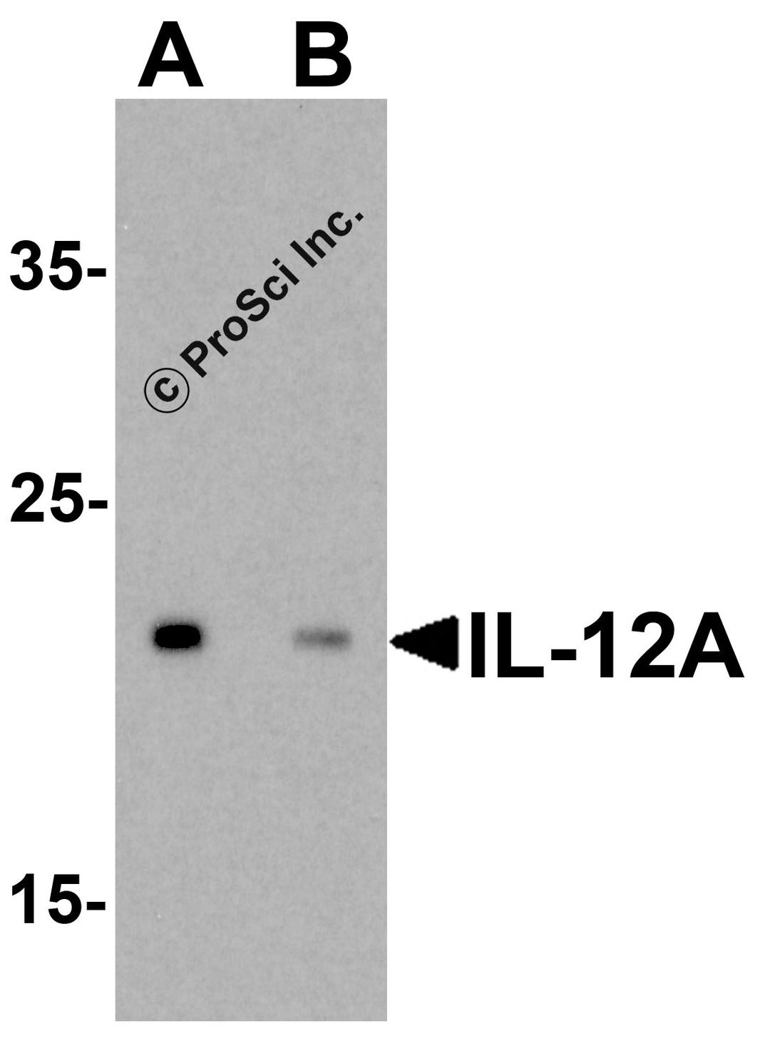 Western blot analysis of IL-12A in HeLa cell lysate with IL-12A antibody at 0.5 μg/ml in (A) the absence and (B) the presence of blocking peptide.