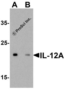 Western blot analysis of IL-12A in HeLa cell lysate with IL-12A antibody at 0.5 μg/ml in (A) the absence and (B) the presence of blocking peptide.