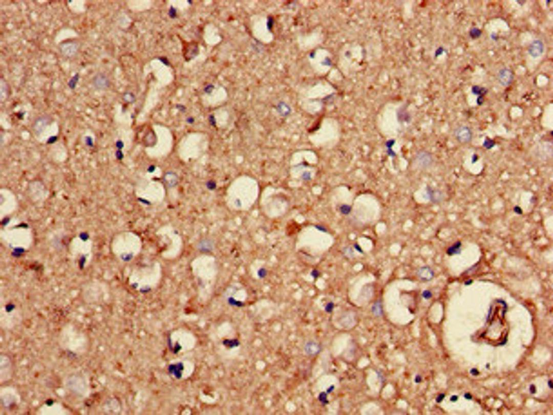 Immunohistochemistry of paraffin-embedded human brain tissue using CSB-PA016070LA01HU at dilution of 1:100