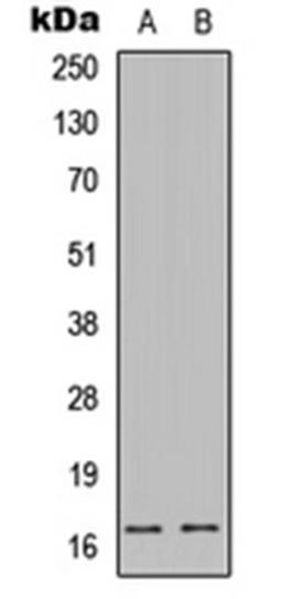 Western blot analysis of HepG2 Etoposide-treated (Lane 1), NIH3T3 Etoposide-treated (Lane 2) whole cell lysates using Caspase 9 p35 antibody