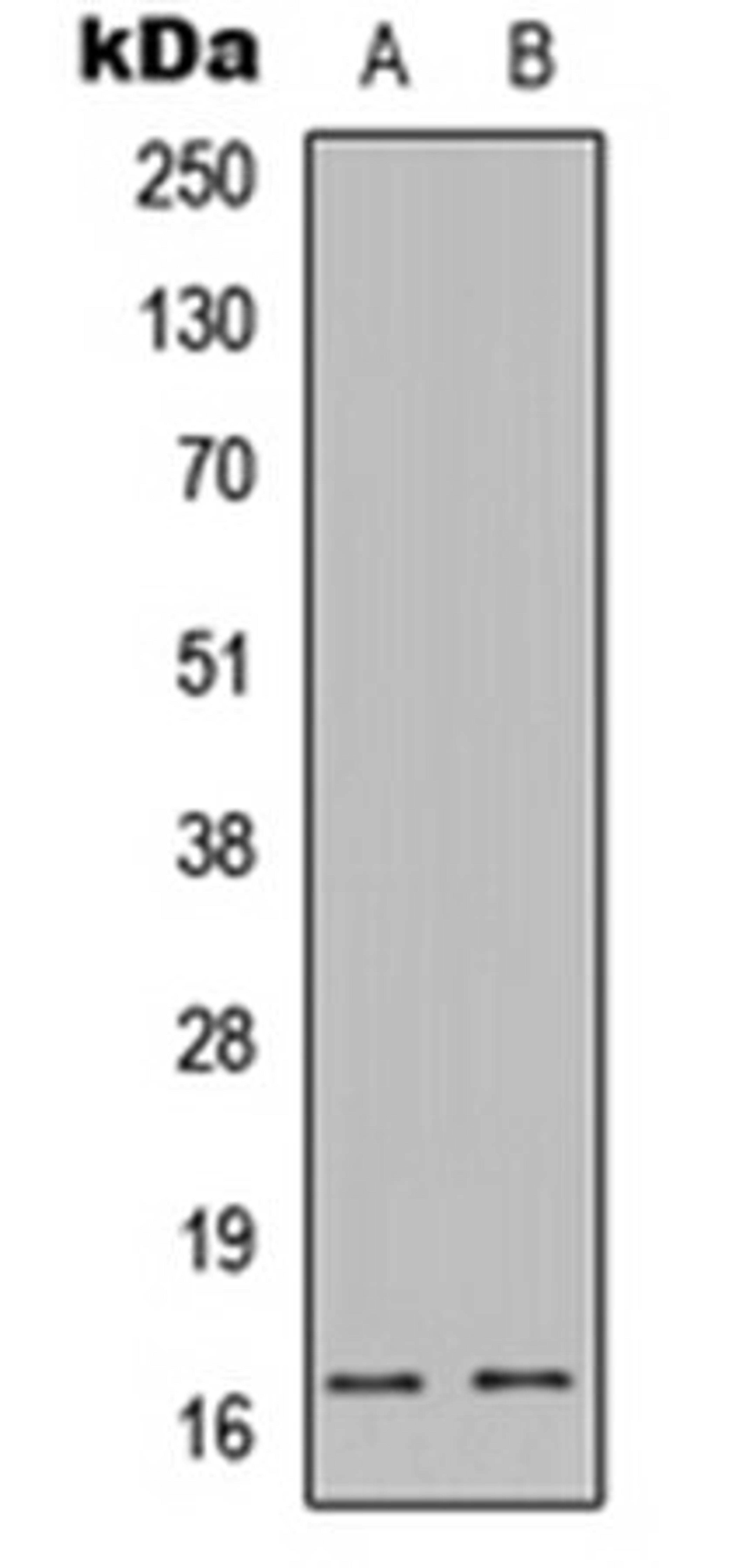 Western blot analysis of HepG2 Etoposide-treated (Lane 1), NIH3T3 Etoposide-treated (Lane 2) whole cell lysates using Caspase 9 p35 antibody