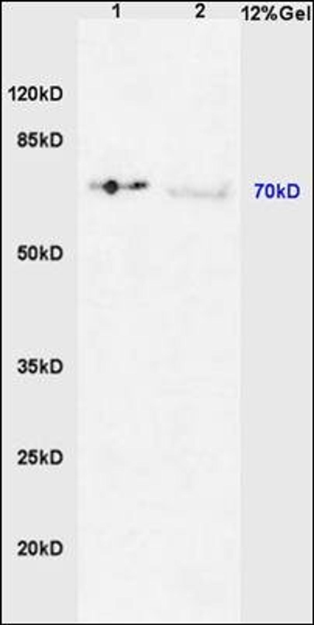 Western blot analysis of mouse liver lysates (Line 1), human colon carcinoma tissue (Line 2) using IRAK1 (phospho-Thr387) antibody.