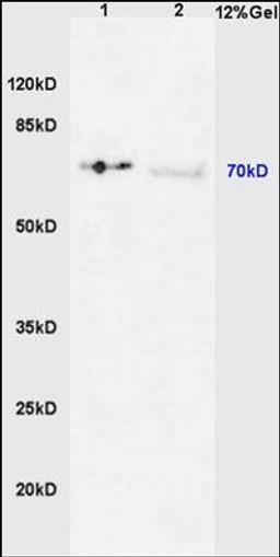 Western blot analysis of mouse liver lysates (Line 1), human colon carcinoma tissue (Line 2) using IRAK1 (phospho-Thr387) antibody.