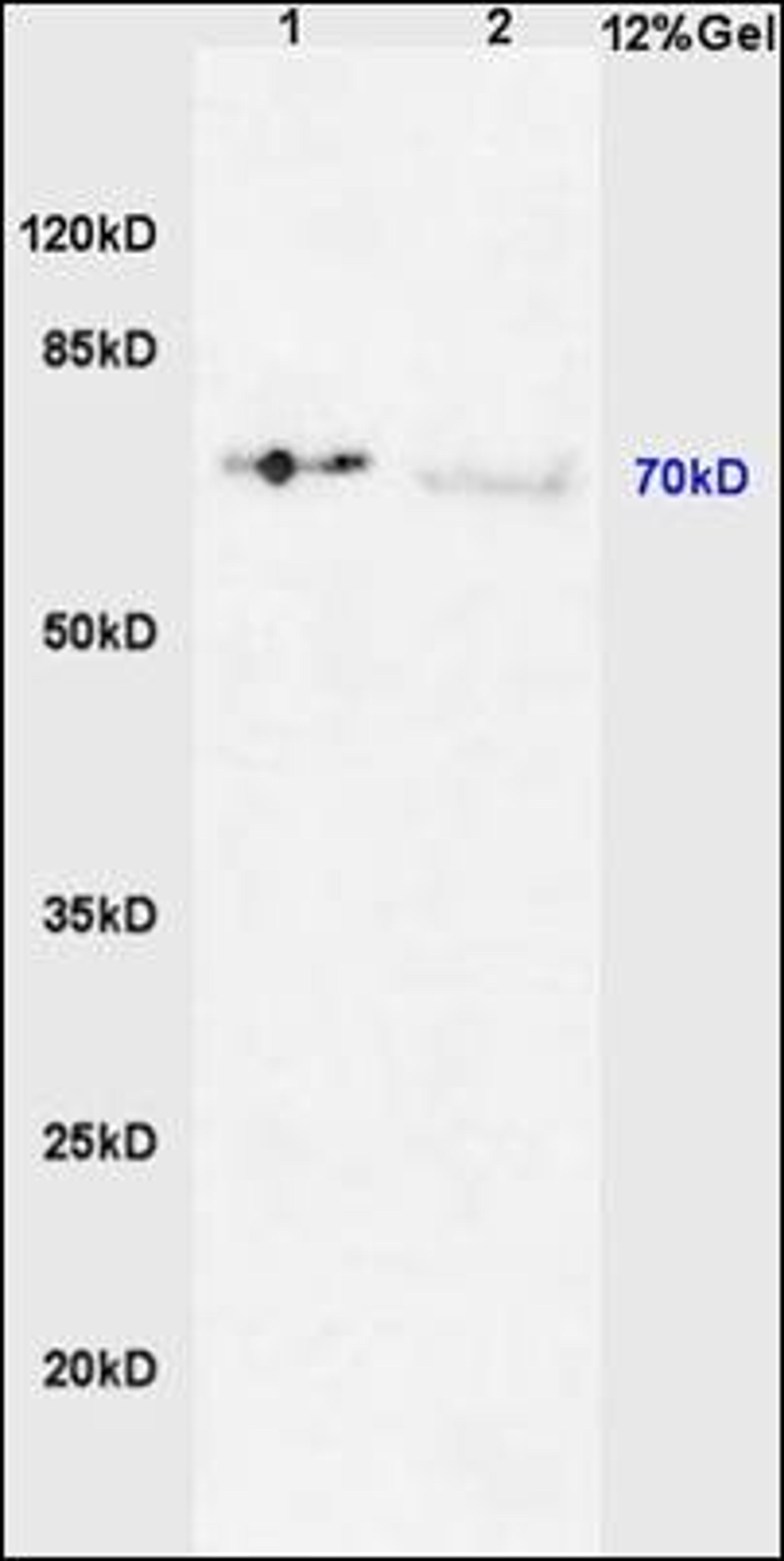 Western blot analysis of mouse liver lysates (Line 1), human colon carcinoma tissue (Line 2) using IRAK1 (phospho-Thr387) antibody.