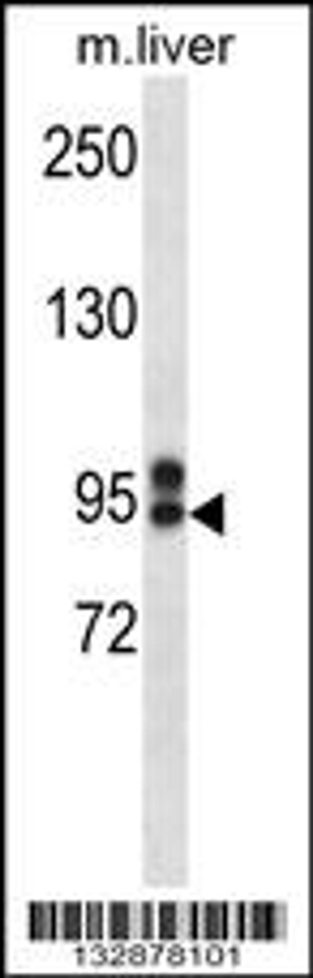 Western blot analysis in mouse liver tissue lysates (35ug/lane).