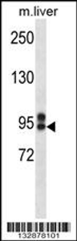 Western blot analysis in mouse liver tissue lysates (35ug/lane).