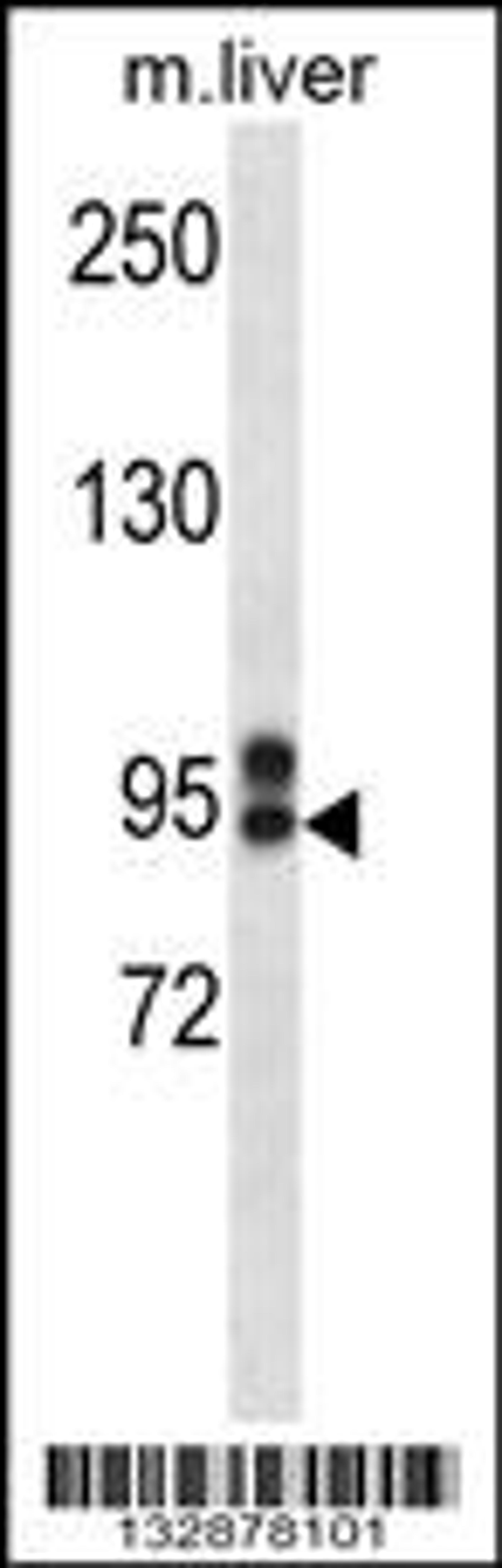 Western blot analysis in mouse liver tissue lysates (35ug/lane).