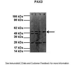 Antibody used in WB on Human cell lines at: 1:1000 (Lane1: 20ug RH30 lysate, Lane2: 20ug RH30 lysate, Lane3: 20ug RH41 lysate, Lane4: 20ug RH41 lysate).