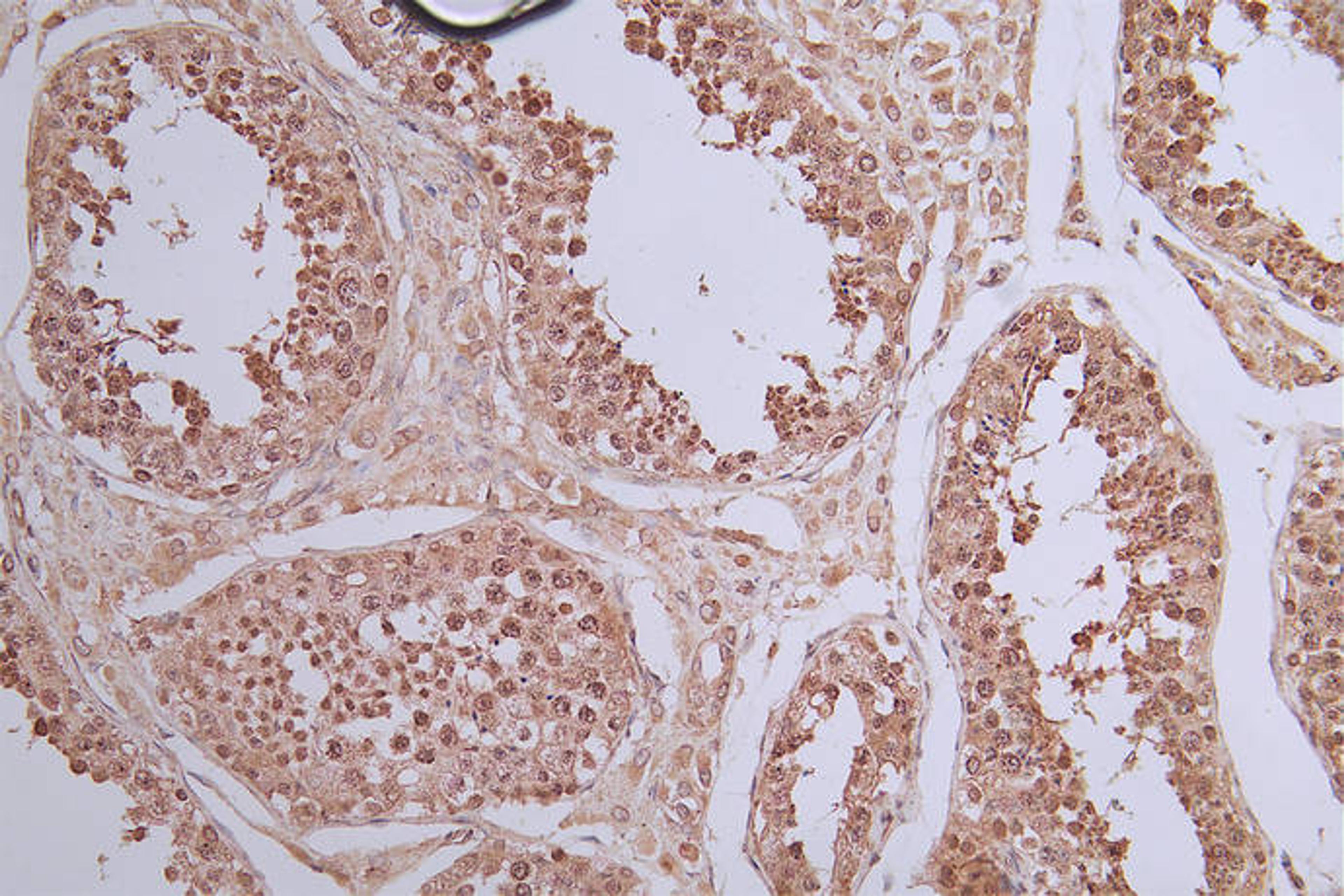 IHC image of CSB-RA989713A0HU diluted at 1:50 and staining in paraffin-embedded human testis tissue performed on a Leica BondTM system. After dewaxing and hydration, antigen retrieval was mediated by high pressure in a citrate buffer (pH 6.0). Section was blocked with 10% normal goat serum 30min at RT. Then primary antibody (1% BSA) was incubated at 4°C overnight. The primary is detected by a Goat anti-rabbit polymer IgG labeled by HRP and visualized using 0.40% DAB.