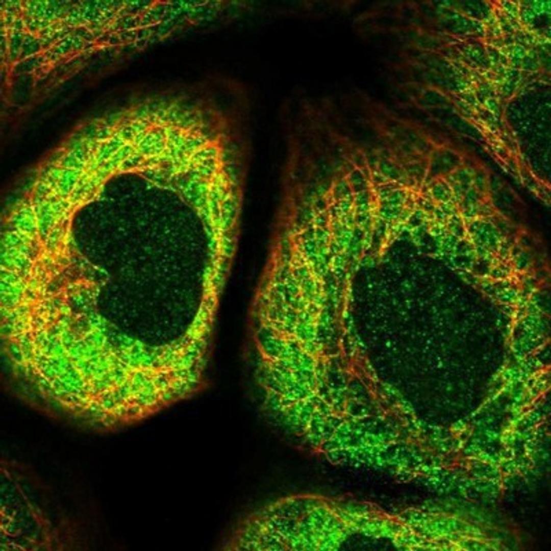 Immunocytochemistry/Immunofluorescence: PRUNE Antibody [NBP1-84055] - Staining of human cell line A-431 shows positivity in cytoplasm.