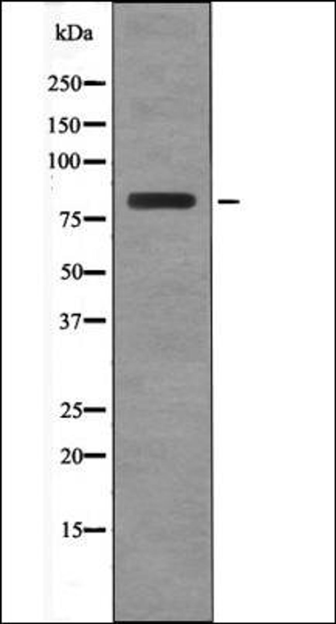 Western blot analysis of EGF treated RAW264.7 whole cell lysates using BRSK2 -Phospho-Thr260- antibody