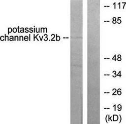 Western blot analysis of extracts from HepG2 cells using Potassium Channel Kv3.2b antibody