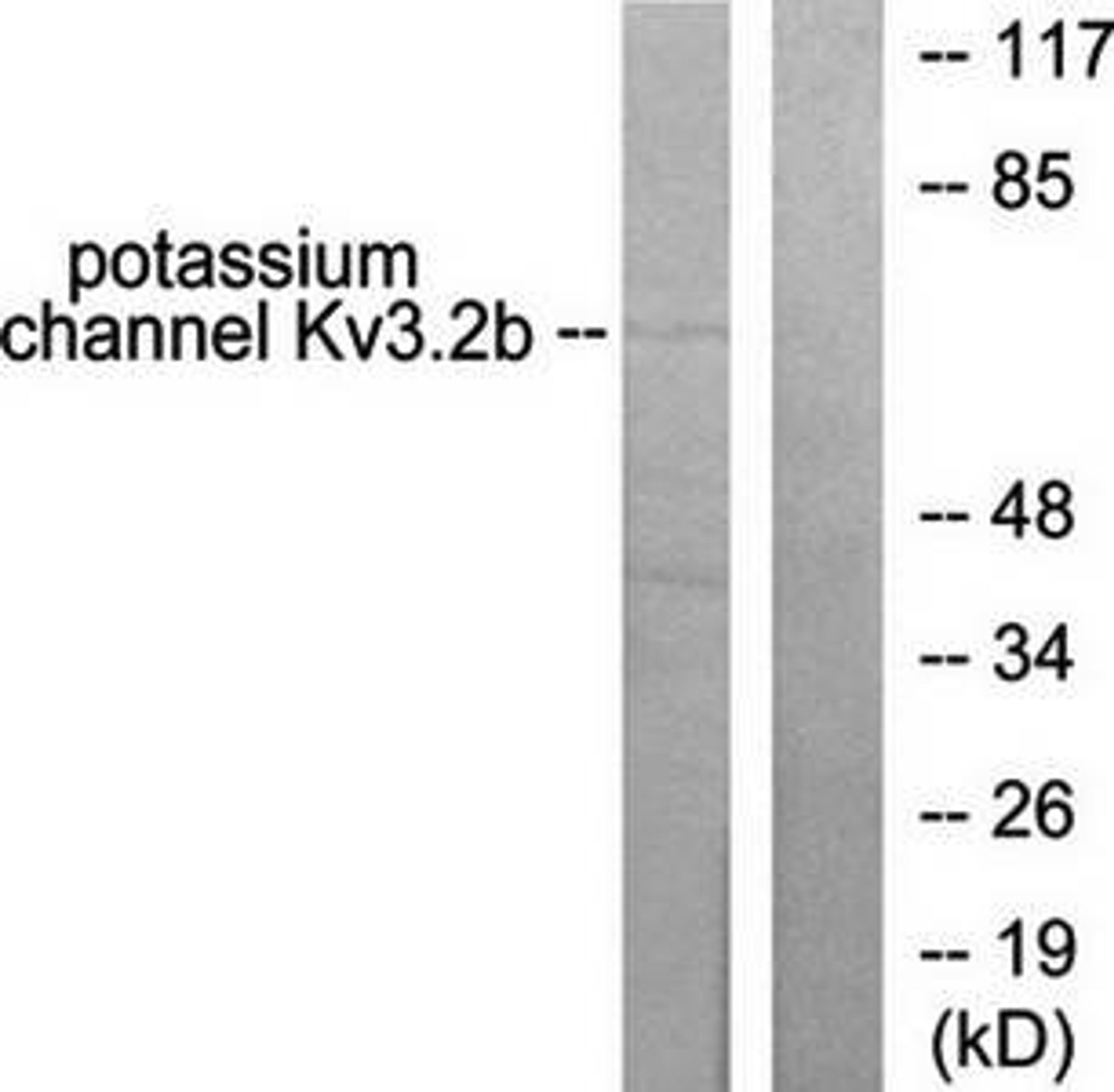 Western blot analysis of extracts from HepG2 cells using Potassium Channel Kv3.2b antibody