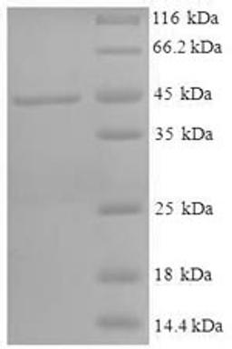 (Tris-Glycine gel) Discontinuous SDS-PAGE (reduced) with 5% enrichment gel and 15% separation gel.