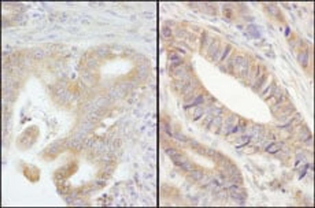 Detection of human PTPN12 by immunohistochemistry.