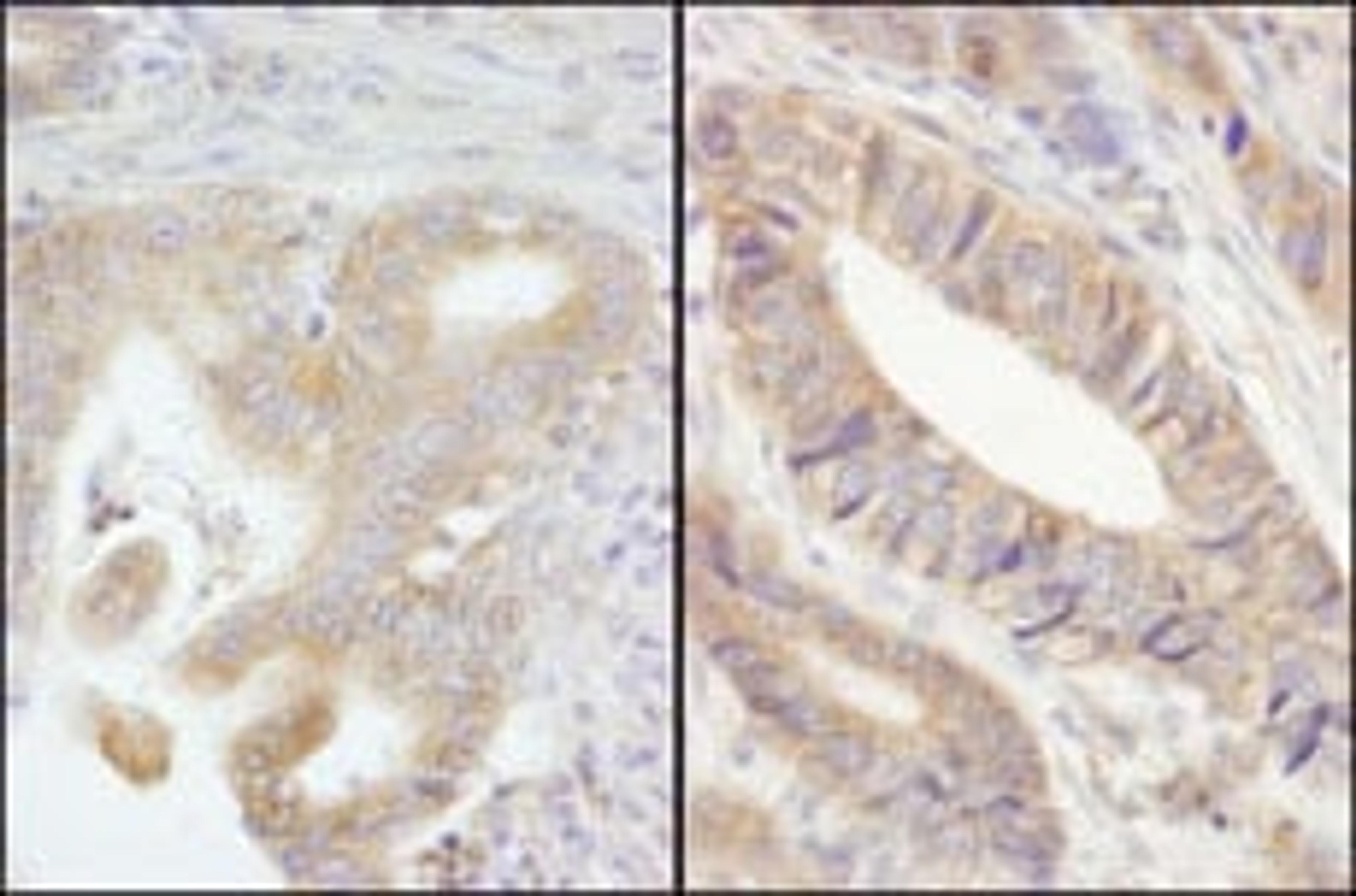 Detection of human PTPN12 by immunohistochemistry.