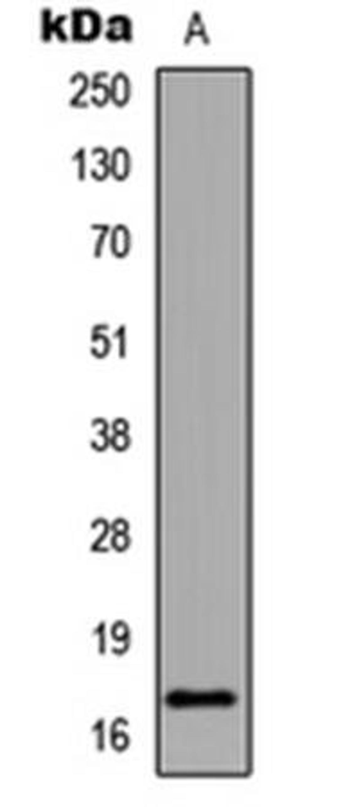 Western blot analysis of HeLa TSA-treated (Lane1) whole cell using Histone H3 (AcK18) antibody