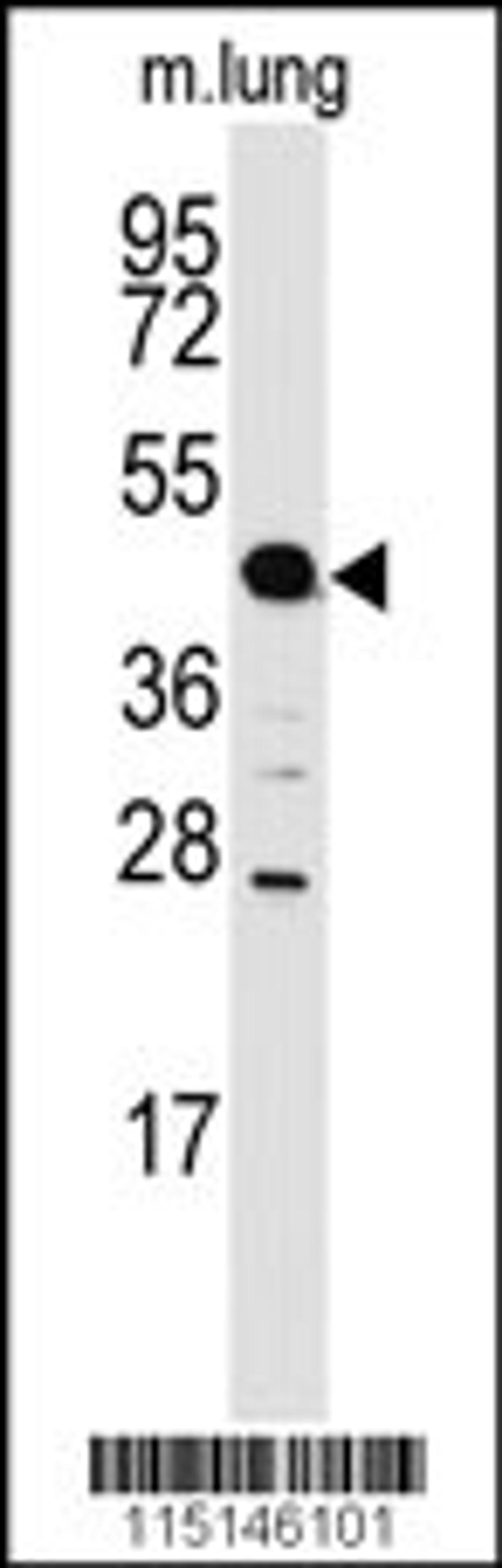 Western blot analysis of anti-ACPP Antibody in mouse lung tissue lysates (35ug/lane)