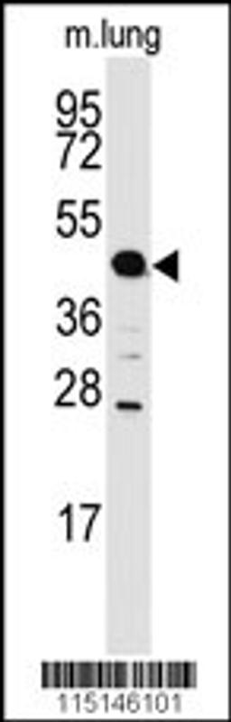 Western blot analysis of anti-ACPP Antibody in mouse lung tissue lysates (35ug/lane)