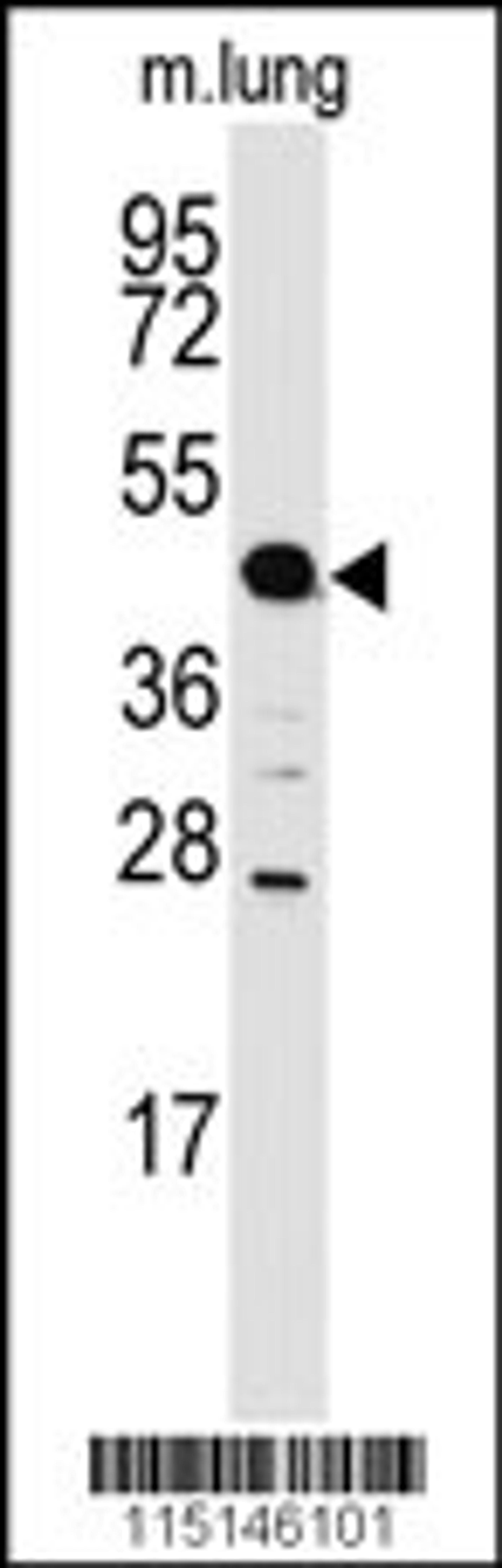 Western blot analysis of anti-ACPP Antibody in mouse lung tissue lysates (35ug/lane)