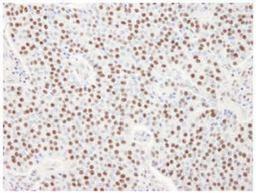 Immunohistochemistry-Paraffin: SART3 Antibody [NB100-74648] - FFPE section of human  pancreatic islet cell tumor.   Affinity purified rabbit anti-SART3 used at a dilution of 1:100. Detection: DAB staining using Immunohistochemistry Accessory Kit