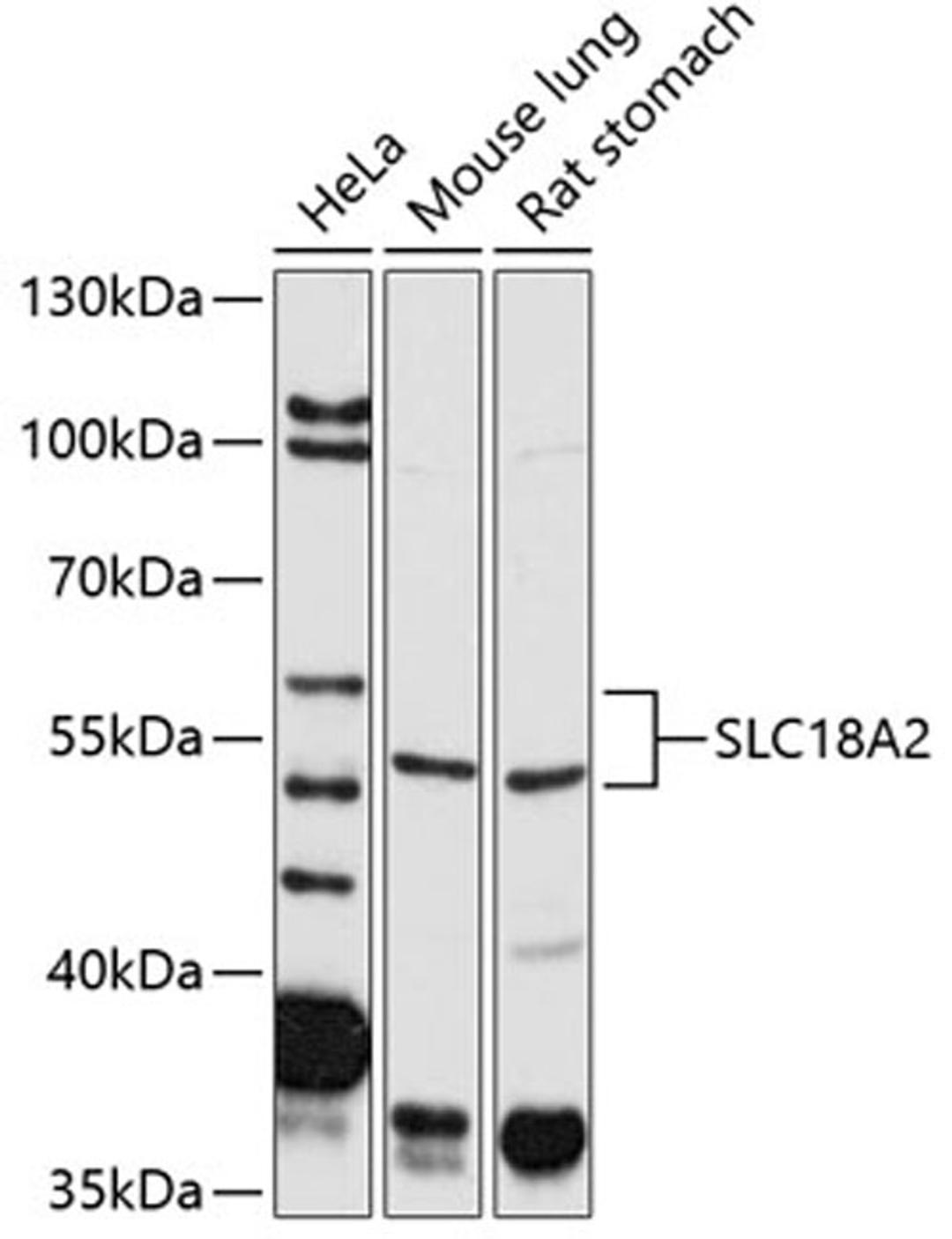 Western blot - SLC18A2 antibody (A2799)