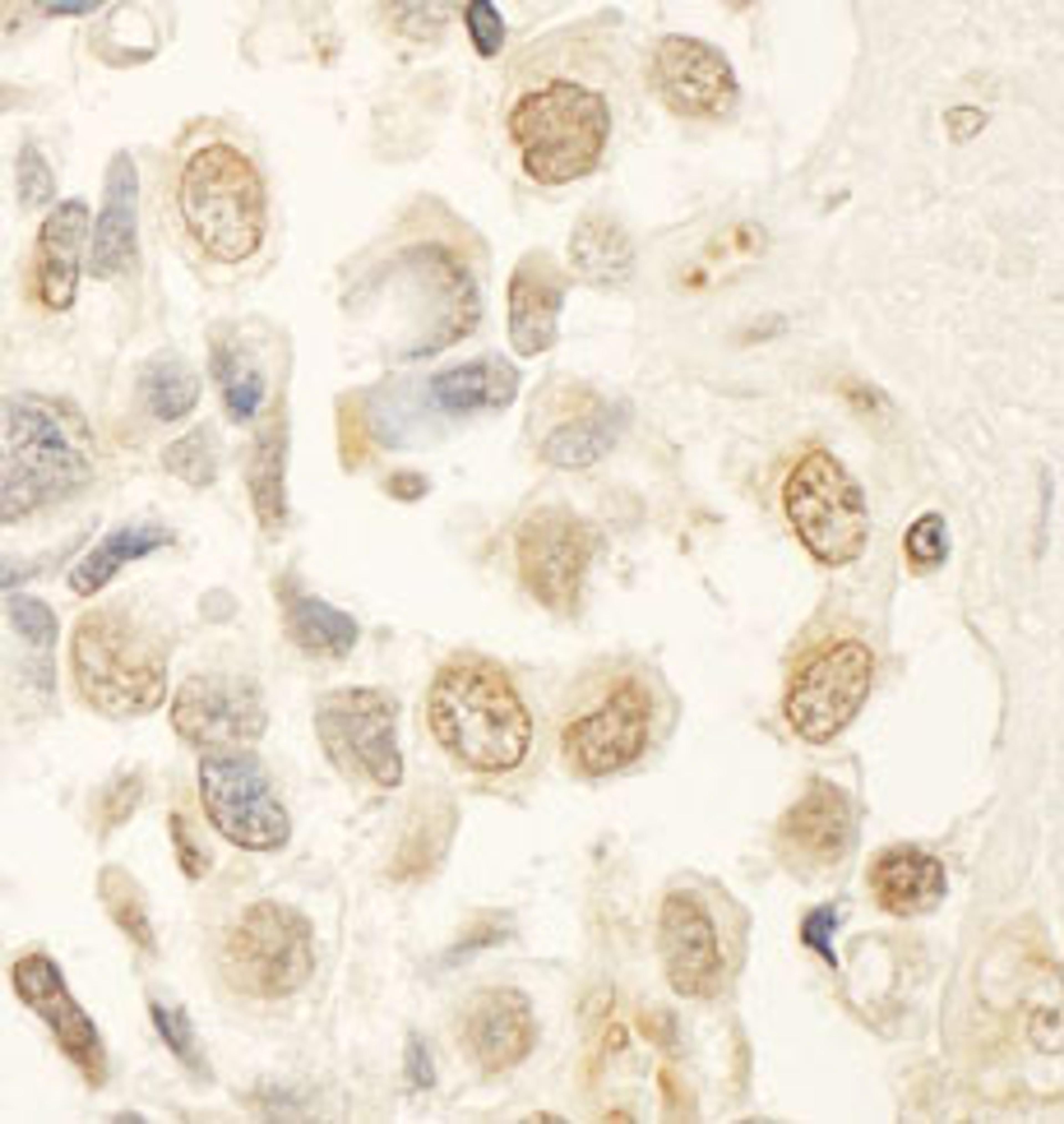 Detection of human HBO by immunohistochemistry.